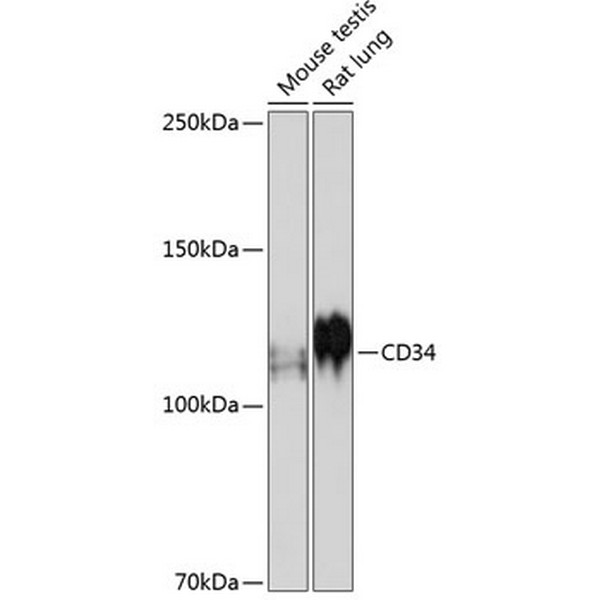 CD34 Rabbit mAb (A19015) CD34 Rabbit mAb (A19015)