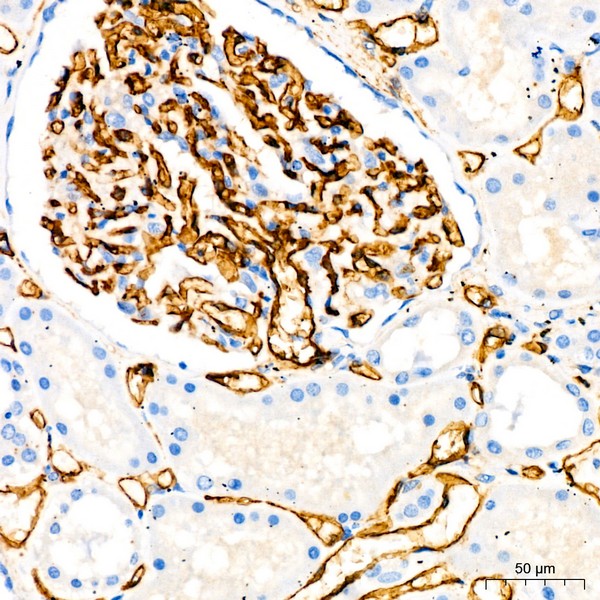 CD34 Rabbit mAb (Catalog Number: A19015) Abclonal