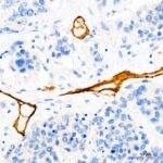 Abclonal CD34 Rabbit mAb (Catalog Number: A19015)