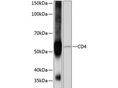 CD4 Rabbit mAb (A19018)