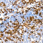 CD4 Rabbit mAb (Catalog Number: A19018) Abclonal