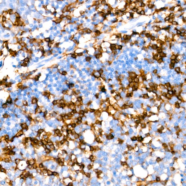 CD4 Rabbit mAb (Catalog Number: A19018) Abclonal