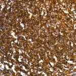 Abclonal CD4 Rabbit mAb (A19018)