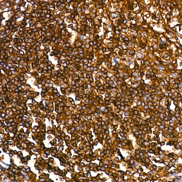 Abclonal CD4 Rabbit mAb (A19018)