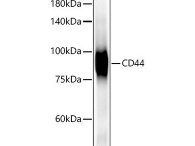 CD44 Rabbit mAb (A19020)