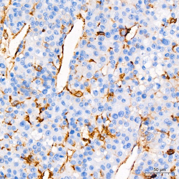 A19020: CD44 Rabbit mAb
