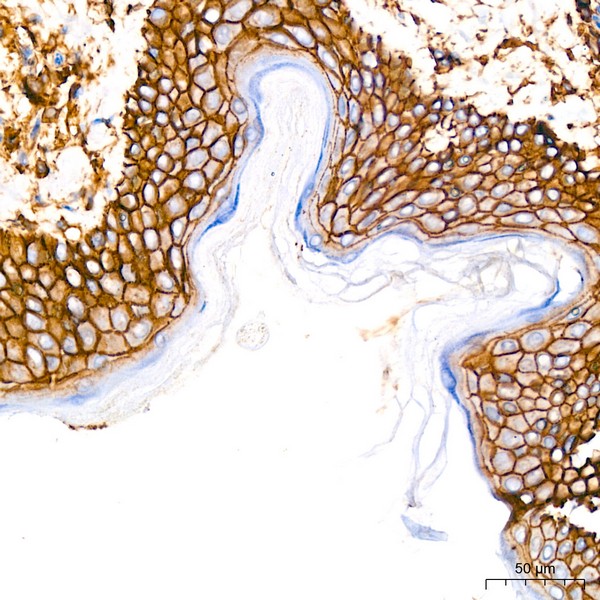 CD44 Rabbit mAb (Catalog Number: A19020) Abclonal