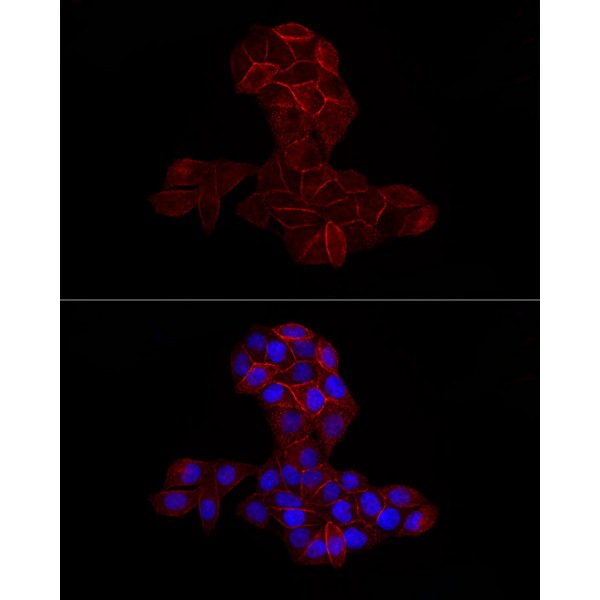 Abclonal CD44 Rabbit mAb (Catalog Number: A19020)