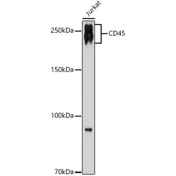 CD45 Rabbit mAb (A19021) CD45 Rabbit mAb (A19021)