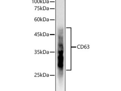 CD63 Rabbit mAb (A19023)