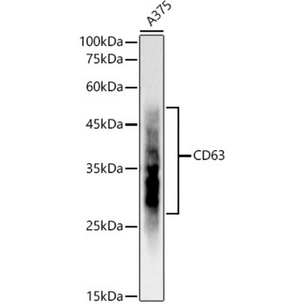 CD63 Rabbit mAb (A19023) CD63 Rabbit mAb (A19023)