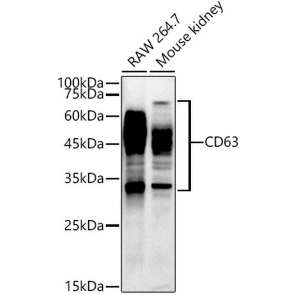 A19023: CD63 Rabbit mAb