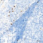 Abclonal CD63 Rabbit mAb (Catalog Number: A19023)