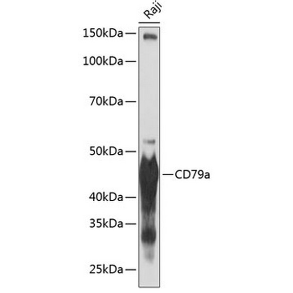 CD79a Rabbit mAb (A19024) CD79a Rabbit mAb (A19024)