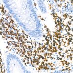 A19024: CD79a Rabbit mAb