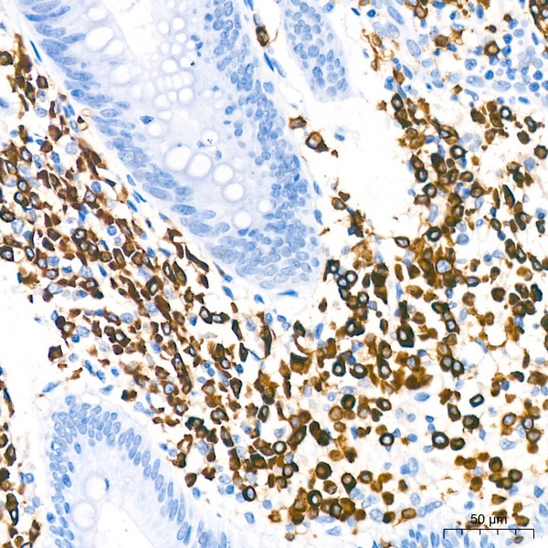 A19024: CD79a Rabbit mAb