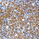 CD79a Rabbit mAb (Catalog Number: A19024) Abclonal