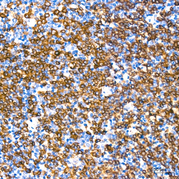 CD79a Rabbit mAb (Catalog Number: A19024) Abclonal