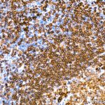 Abclonal CD79a Rabbit mAb (Catalog Number: A19024)