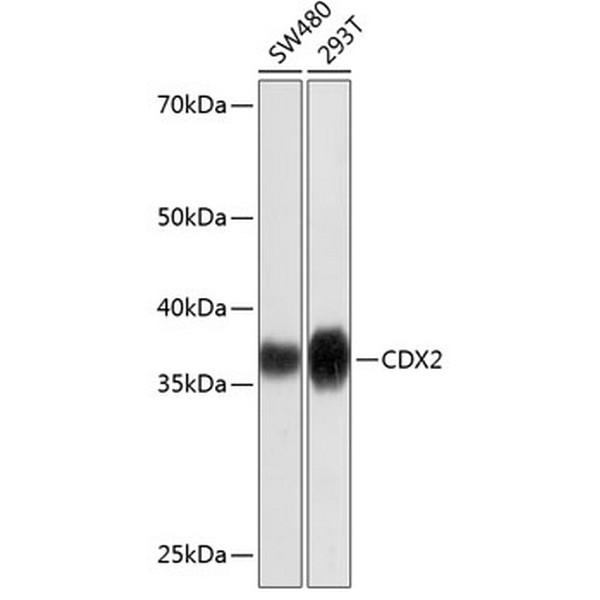 [KO Validated] CDX2 Rabbit mAb (A19030)