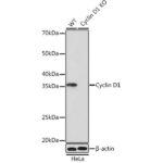 [KO Validated] Cyclin D1 Rabbit mAb (A19038)