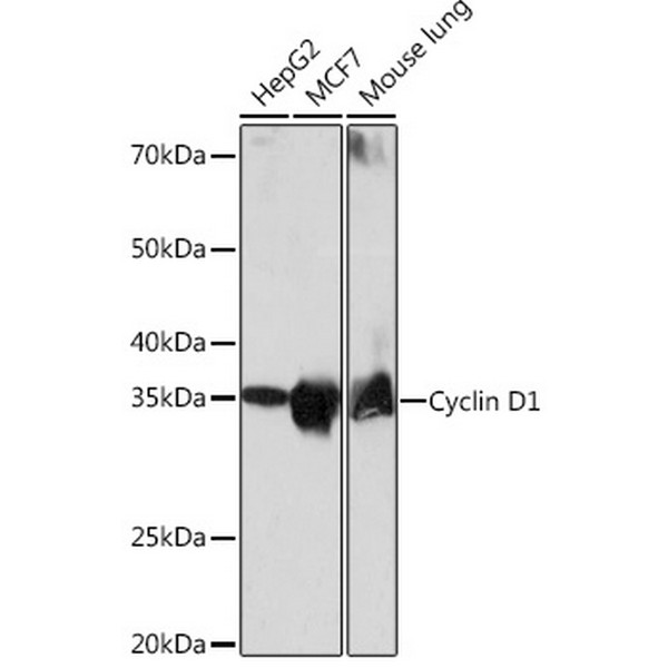 A19038: [KO Validated] Cyclin D1 Rabbit mAb