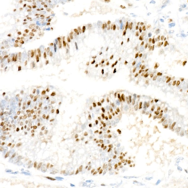 [KO Validated] Cyclin D1 Rabbit mAb (Catalog Number: A19038) Abclonal