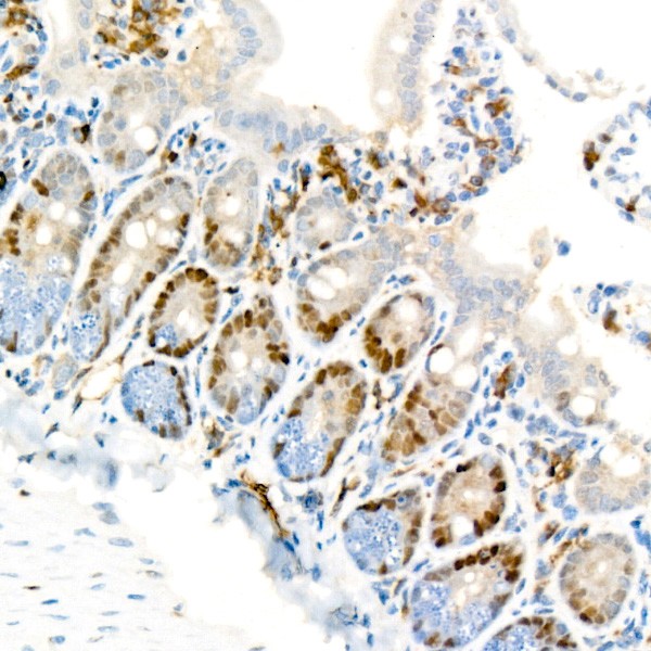 Abclonal [KO Validated] Cyclin D1 Rabbit mAb (Catalog Number: A19038)