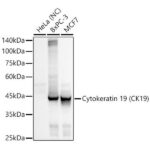Cytokeratin 19 (CK19) Rabbit mAb (A19040)