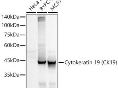Cytokeratin 19 (CK19) Rabbit mAb (A19040)