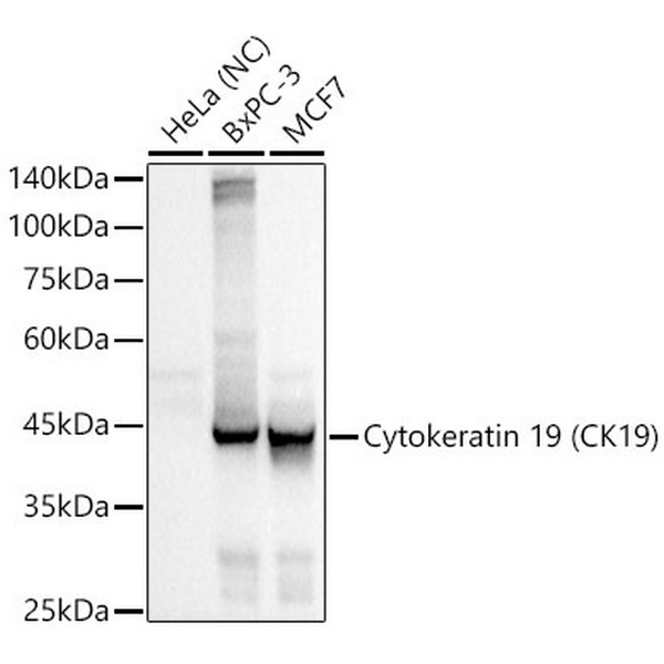 Cytokeratin 19 (CK19) Rabbit mAb (A19040)
