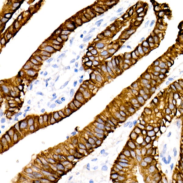 Cytokeratin 19 (CK19) Rabbit mAb (Catalog Number: A19040) Abclonal