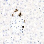 Abclonal Cytokeratin 19 (CK19) Rabbit mAb (Catalog Number: A19040)