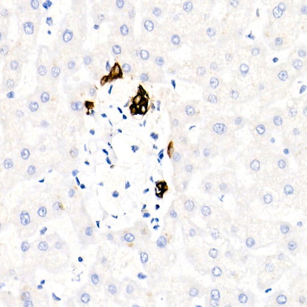 Abclonal Cytokeratin 19 (CK19) Rabbit mAb (Catalog Number: A19040)