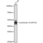 Cytokeratin 20 (CK20) Rabbit mAb (A19041)