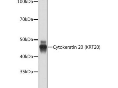 Cytokeratin 20 (CK20) Rabbit mAb (A19041)