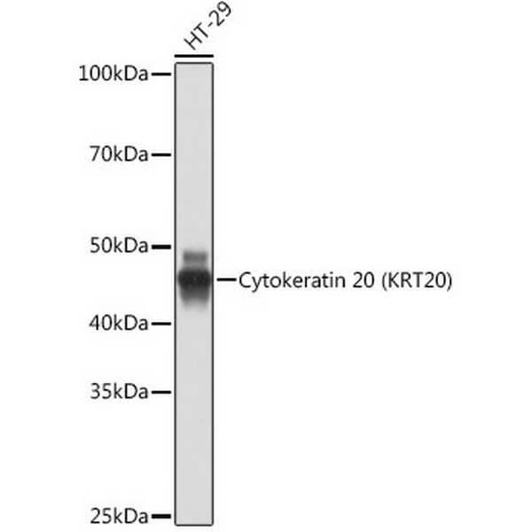 Cytokeratin 20 (CK20) Rabbit mAb (A19041) Cytokeratin 20 (CK20) Rabbit mAb (A19041)