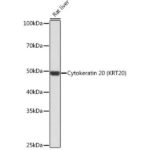 A19041: Cytokeratin 20 (CK20) Rabbit mAb