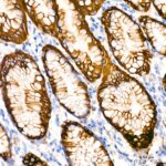 Cytokeratin 20 (CK20) Rabbit mAb (Catalog Number: A19041) Abclonal