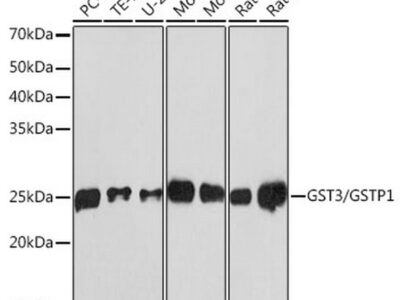 GST3/GSTP1 Rabbit mAb (A19061)