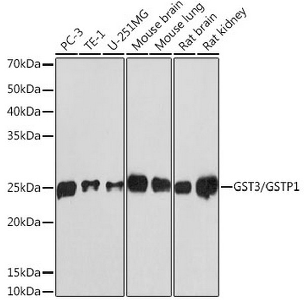 GST3/GSTP1 Rabbit mAb (A19061)
