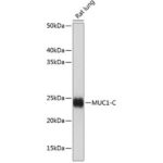 MUC1 Rabbit mAb (A19081)