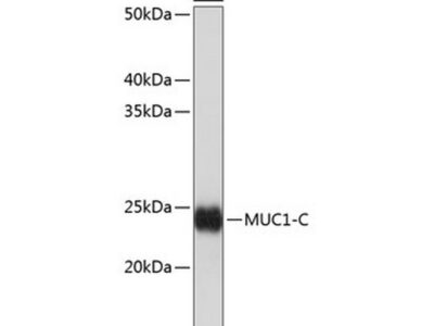 MUC1 Rabbit mAb (A19081)