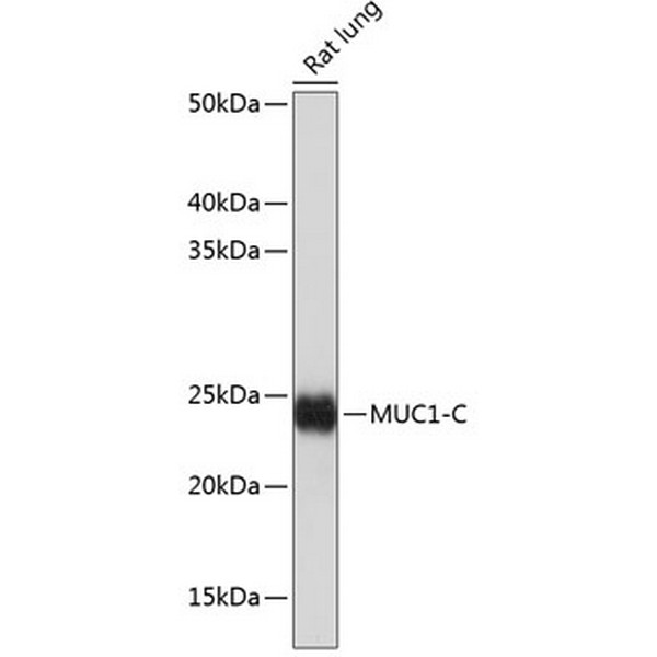 MUC1 Rabbit mAb (A19081)