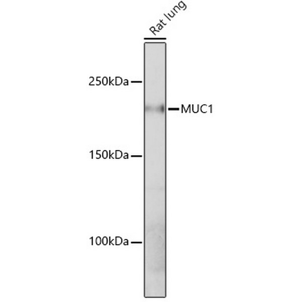 A19081: MUC1 Rabbit mAb