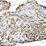 Abclonal MUC1 Rabbit mAb (Catalog Number: A19081)