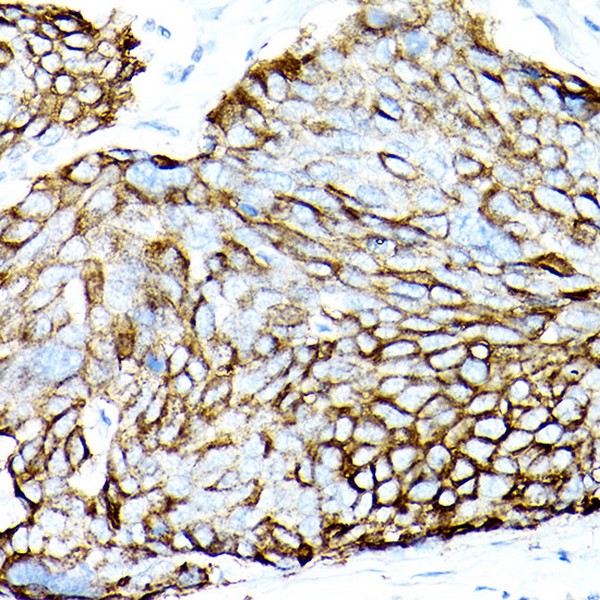 Abclonal MUC1 Rabbit mAb (Catalog Number: A19081)