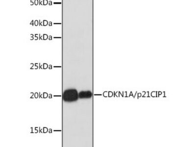 [KO Validated] CDKN1A/p21 Rabbit mAb (A19094)