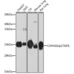 CDKN1B/p27KIP1 Rabbit mAb (A19095)