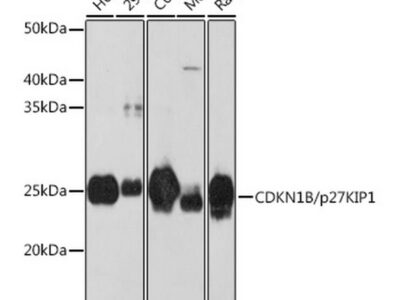 CDKN1B/p27KIP1 Rabbit mAb (A19095)